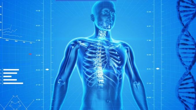 Osteoperose